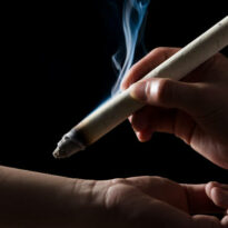 Moxibustion